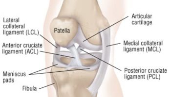 Acl Tears An Osteo Perspective